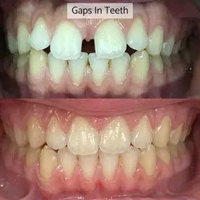 Bild von Whites Dental Marble Arch (W2)