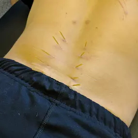 Bild von Athletes' Potential Columbus