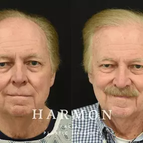 Bild von Harmon Facial Plastic Surgery