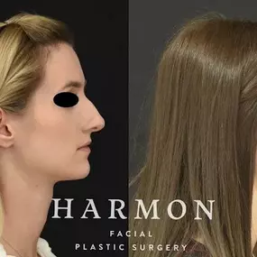 Bild von Harmon Facial Plastic Surgery