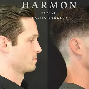 Bild von Harmon Facial Plastic Surgery