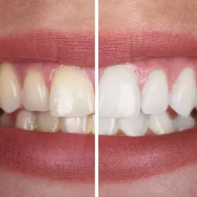Bild von Oral Health Center/Dental Care Westerville