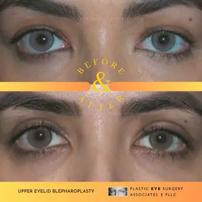 Bild von Plastic Eye Surgery Associates, PLLC