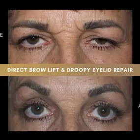 Bild von Plastic Eye Surgery Associates, PLLC