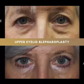 Bild von Plastic Eye Surgery Associates, PLLC