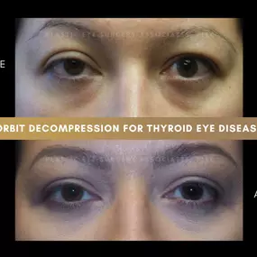Bild von Plastic Eye Surgery Associates, PLLC