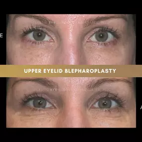 Bild von Plastic Eye Surgery Associates, PLLC