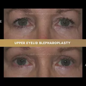 Bild von Plastic Eye Surgery Associates, PLLC