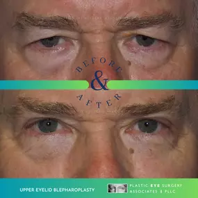 Bild von Plastic Eye Surgery Associates, PLLC