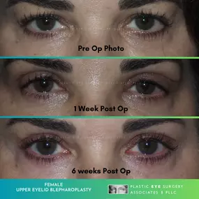Bild von Plastic Eye Surgery Associates, PLLC