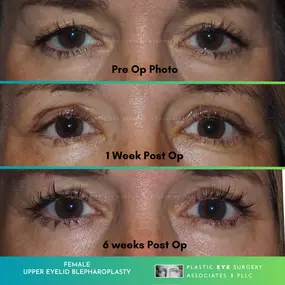 Bild von Plastic Eye Surgery Associates, PLLC