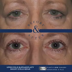 Bild von Plastic Eye Surgery Associates, PLLC