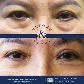 Bild von Plastic Eye Surgery Associates, PLLC