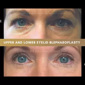 Bild von Plastic Eye Surgery Associates, PLLC