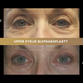Bild von Plastic Eye Surgery Associates, PLLC