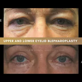 Bild von Plastic Eye Surgery Associates, PLLC