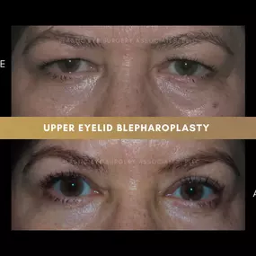 Bild von Plastic Eye Surgery Associates, PLLC