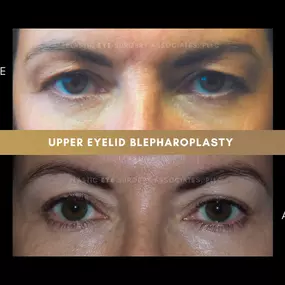 Bild von Plastic Eye Surgery Associates, PLLC