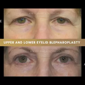 Bild von Plastic Eye Surgery Associates, PLLC