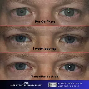 Bild von Plastic Eye Surgery Associates, PLLC