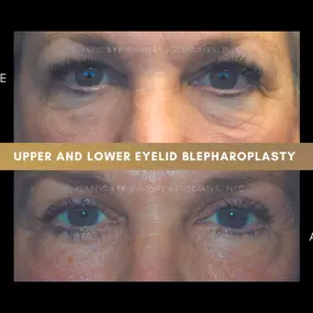 Bild von Plastic Eye Surgery Associates, PLLC