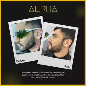 Bild von Alpha Laser Clinic Bradford