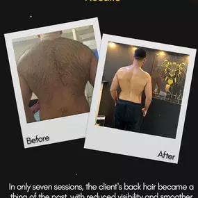 Bild von Alpha Laser Clinic Bradford