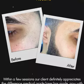 Bild von Alpha Laser Clinic Bradford