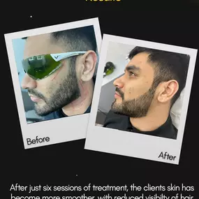 Bild von Alpha Laser Clinic Bradford