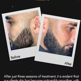Bild von Alpha Laser Clinic Bradford