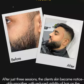 Bild von Alpha Laser Clinic Bradford