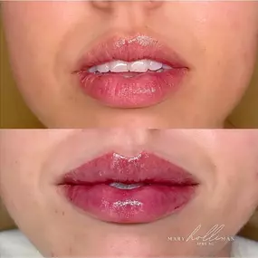 holli b&a 2