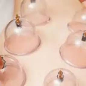 Massage Cupping