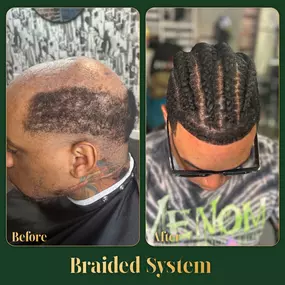 Bild von Ace of Fades 212 - Hair Replacement Studio