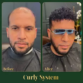 Bild von Ace of Fades 212 - Hair Replacement Studio