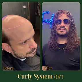 Bild von Ace of Fades 212 - Hair Replacement Studio