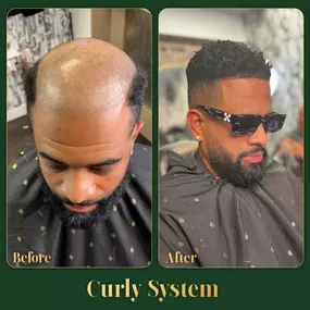 Bild von Ace of Fades 212 - Hair Replacement Studio