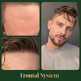 Bild von Ace of Fades 212 - Hair Replacement Studio