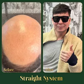 Bild von Ace of Fades 212 - Hair Replacement Studio