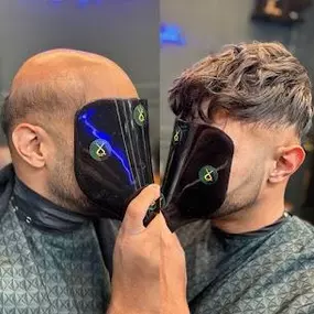 Bild von Ace of Fades 212 - Hair Replacement Studio