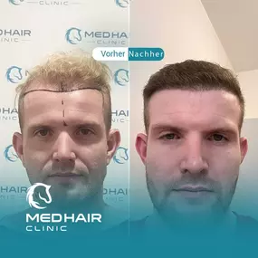 Bild von MedHair Clinic | Haartransplantation Türkei