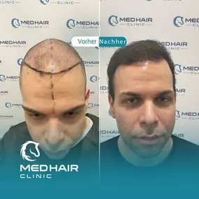 Bild von MedHair Clinic | Haartransplantation Türkei