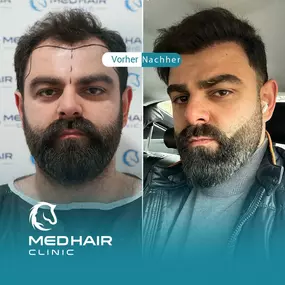 Bild von MedHair Clinic | Haartransplantation Türkei
