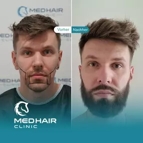 Bild von MedHair Clinic | Haartransplantation Türkei