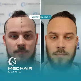 Bild von MedHair Clinic | Haartransplantation Türkei