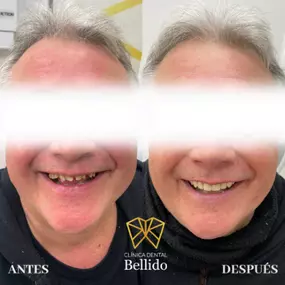 bellido3.png