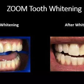 Bild von North Miami Dental Group