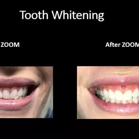 Bild von North Miami Dental Group