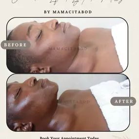 lymphatic massage face