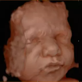 Bild von Womb With A View